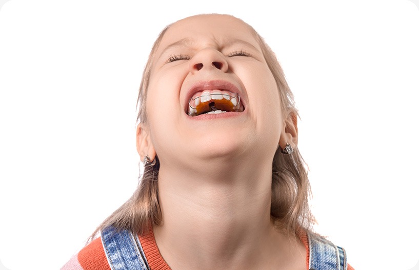 childrens-dentistry-orthodontic-appliances-donsdale-dental-west-edmonton-family-and-general-dentist Children's Dentistry | Donsdale Dental | West Edmonton | Family and General Dentist