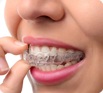 Edmonton Invisalign | Donsdale Dental | West Edmonton | Family and General Dentist