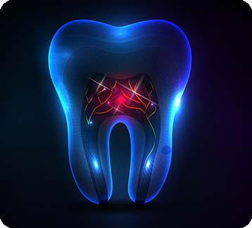 Edmonton Root Canal Therapy | Donsdale Dental | West Edmonton | Family and General Dentist