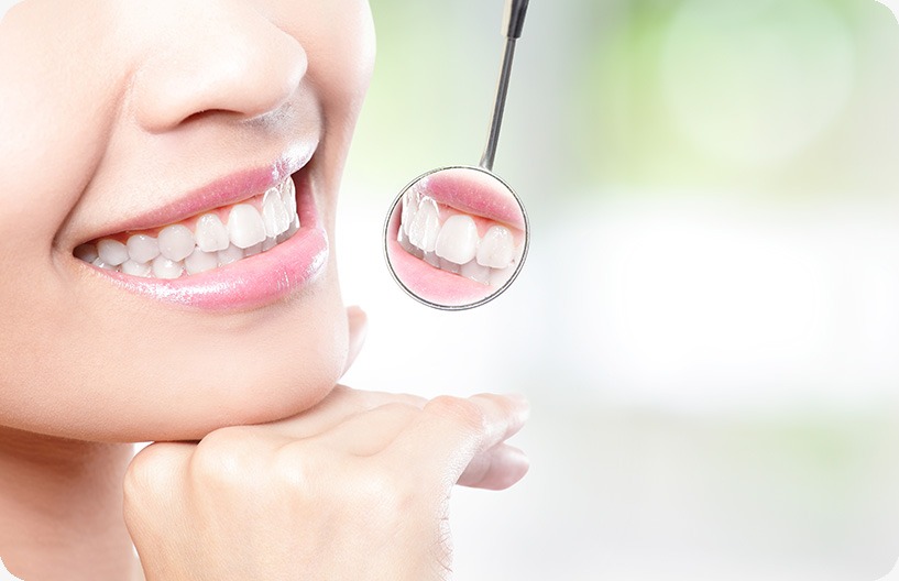 Teeth Whitening | Donsdale Dental | West Edmonton | Family and General Dentist